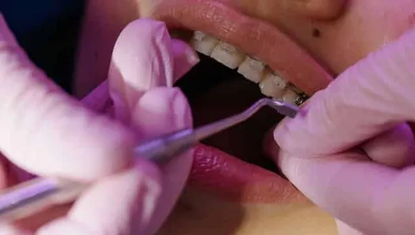 Ortodontka sprawdza aparat stały narzędziem dentystycznym podczas wizyty