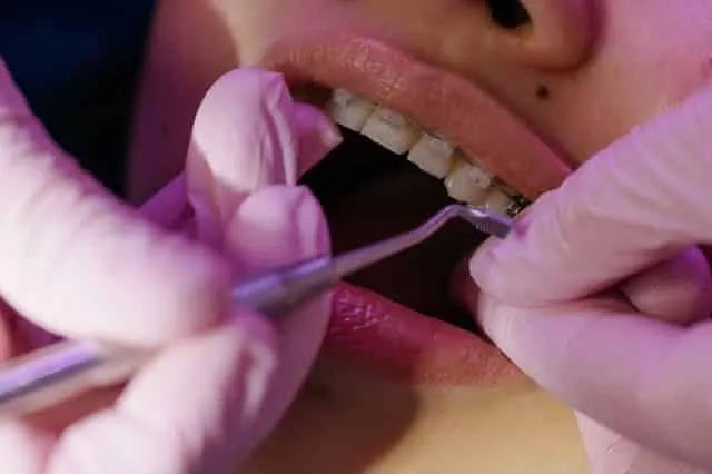 Ortodontka sprawdza aparat stały narzędziem dentystycznym podczas wizyty