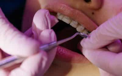 Co warto wiedzieć przed pierwszą wizytą u ortodonty?