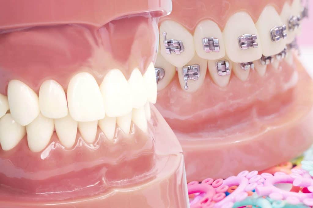 Wosk ortodontyczny