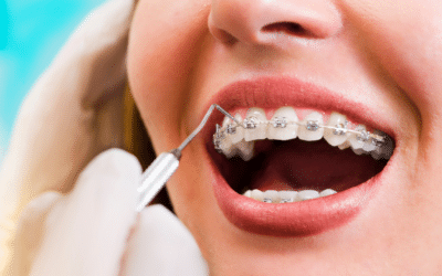 Leczenie ortodontyczne – Jakie daje korzyści?